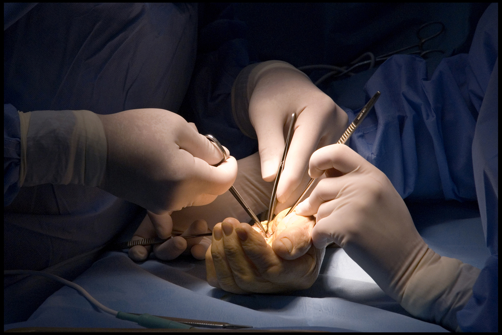 Exploring Wrist Surgery Options from Dr. Yorell Manon-Matos