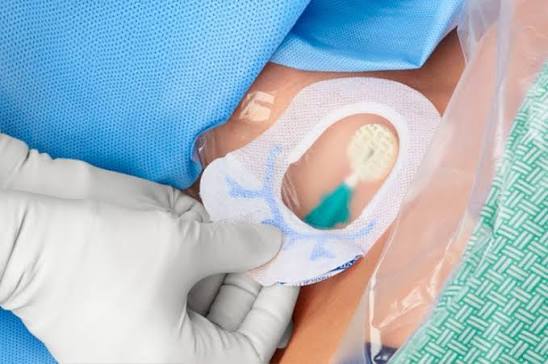 Central Line Dressing Trays: Their Role in Health-care Simulation